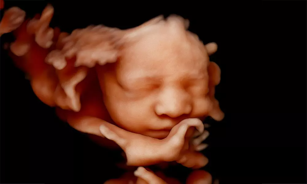 Tu bebé más cerca: ecografía 4D-5D emocional básica o plus