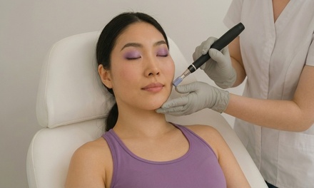 One Microneedling Treatment - Gem Aesthetic and Skin Clinic