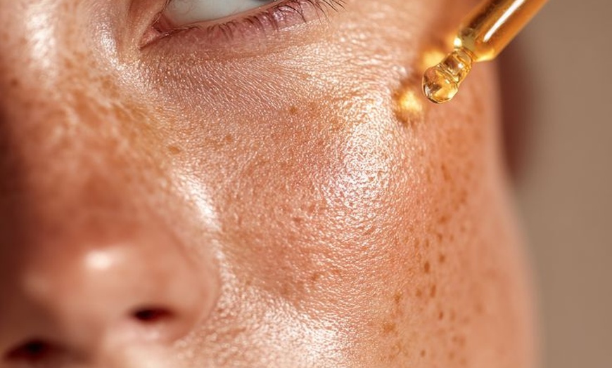 Image 19: Glow with HydraFacial and CO₂ Mask Therapy w/w/o Radiofrequency