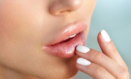 Infiltración de 1 vial de 1.1 ml de relleno dérmico - Luxxia Clinic