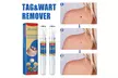 Skin Mole Removal Pen From Ever Mercantile (Up To 69% Off); Free Shipping - Image 4