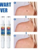 Image 4: Skin Mole Removal Pen