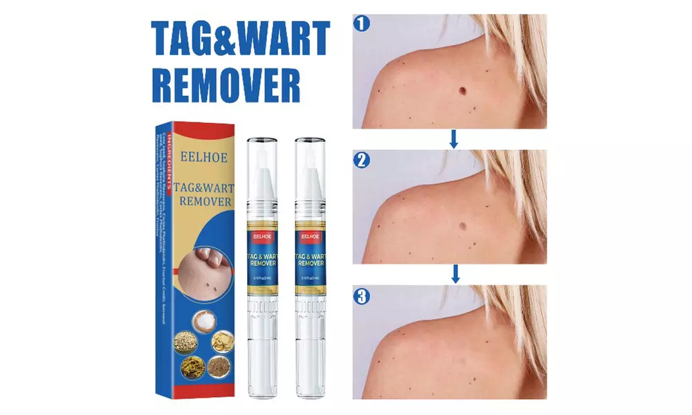 Skin Mole Removal Pen