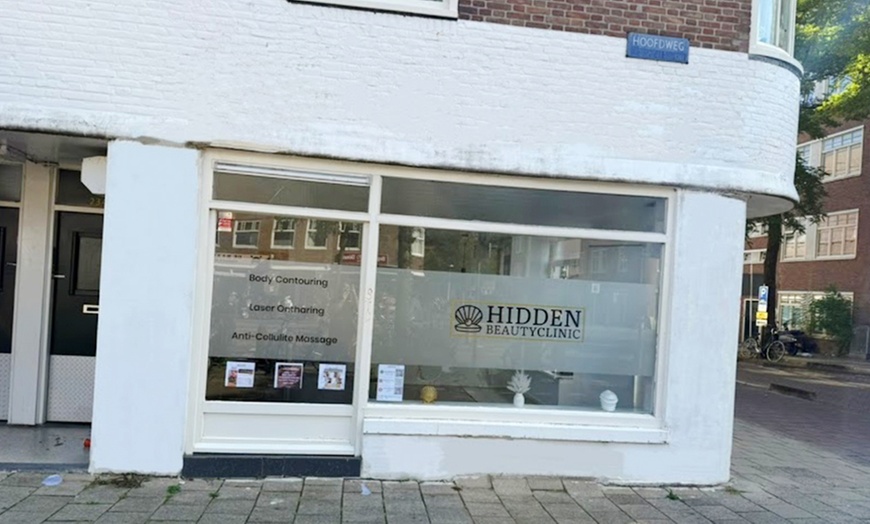 Image 5: Zichtbare versteviging zonder chirurgische ingreep