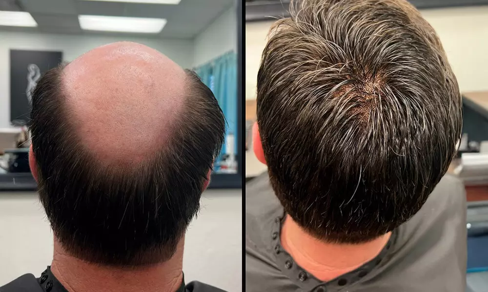 Raquel Welch Topper: Chameleon, Lyric & Charmed Life + Cut & Style