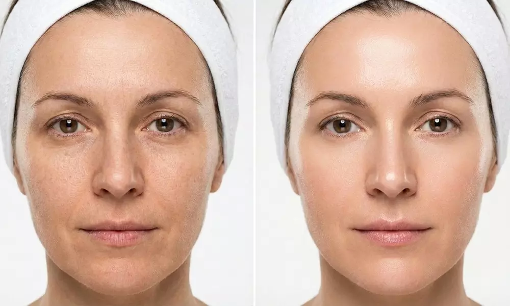 Radiant Skin w/ One, Two or Three 60 Min Basic Facial Sessions for One