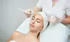 Revitalize Your Skin with IV Chemical Peel (Medical Grade) at Vitality Vision Med Spa & Wellness (Up to 35% Off)