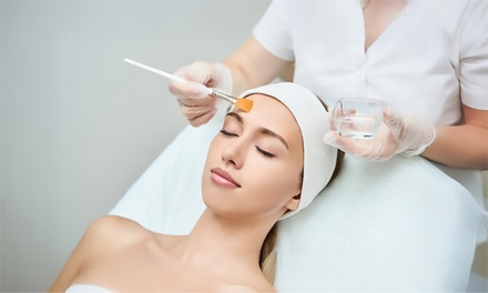 One Session of IV Chemical Peel (Medical Grade) - Vitality Vision Med Spa & Wellness