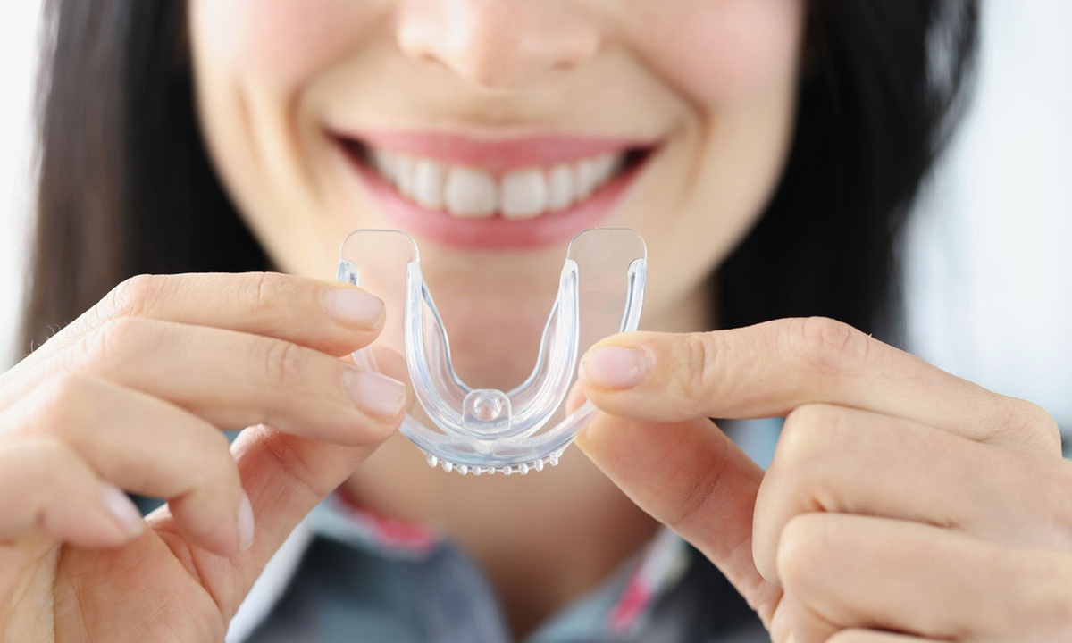 Férula de descarga semirrígida para proteger la sonrisa