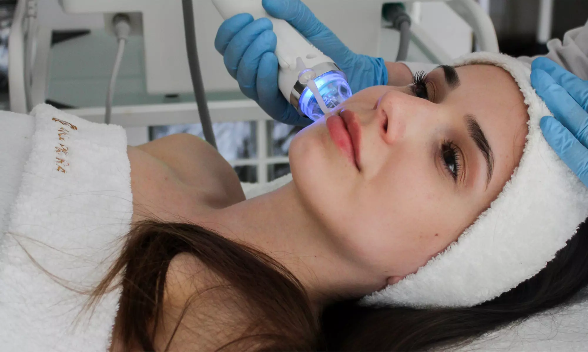 Lifting i redukcja zmarszczek: RF frakcyjny mikroigłowy