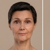 Image 3: Skinvive Hydration & Radiesse Contour Fillers for Radiant Skin