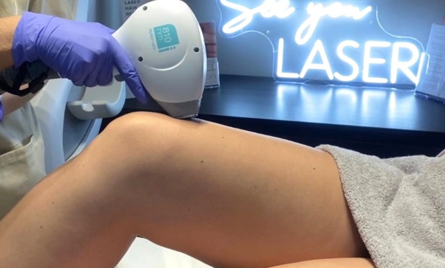 Image 5: Get Smooth Skin: Laser Hair Removal 