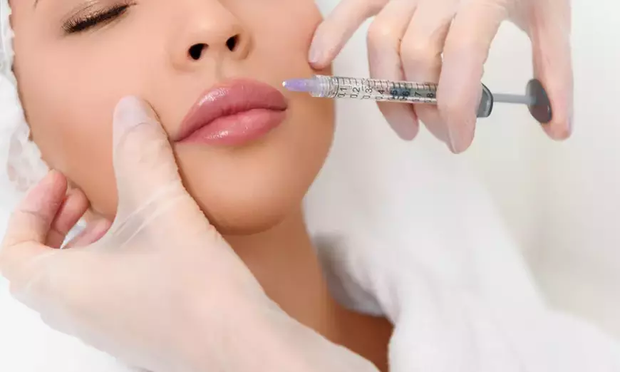 One Syringe of Revanesse Dermal Filler Injection at BodyBrite