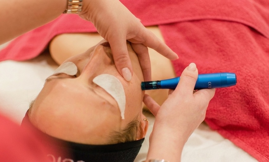 Image 8: Gezichtsbehandeling of huidverbetering naar keuze