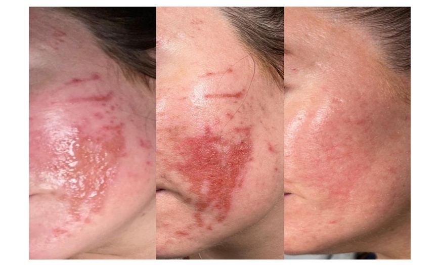 Image 7: Choose Medical Dermalux MD Triwave LED Light Therapy Pak of 10 or 20 