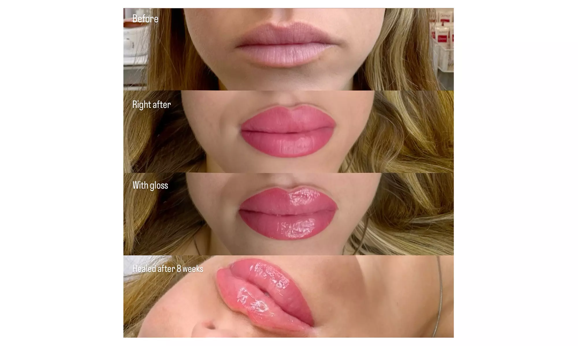 Up to 42% Off on Permanent Makeup at Skin Clinic