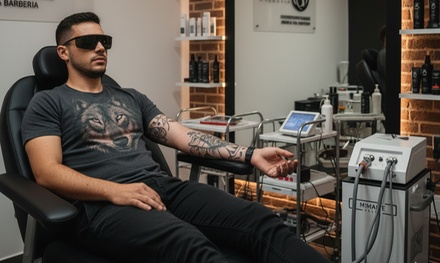 3 sesiones de eliminación de tatuajes con láser, hasta 25 cm² - Mimarte Estudio
