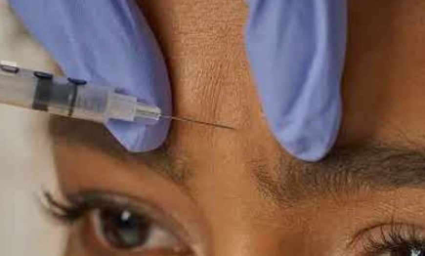 Image 3: 35% Off 20 or 40 Units of Letybo at Trimbody MD San Marcos
