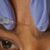 Image 3: 35% Off 20 or 40 Units of Letybo at Trimbody MD San Marcos