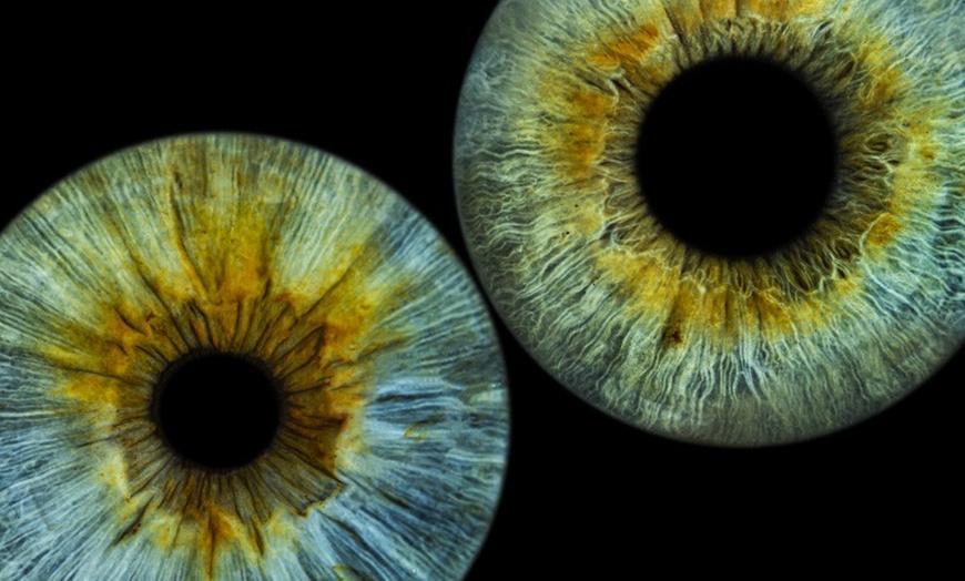 Image 15: Fotografía artística del iris del ojo con impresión en 15 x 20 cm