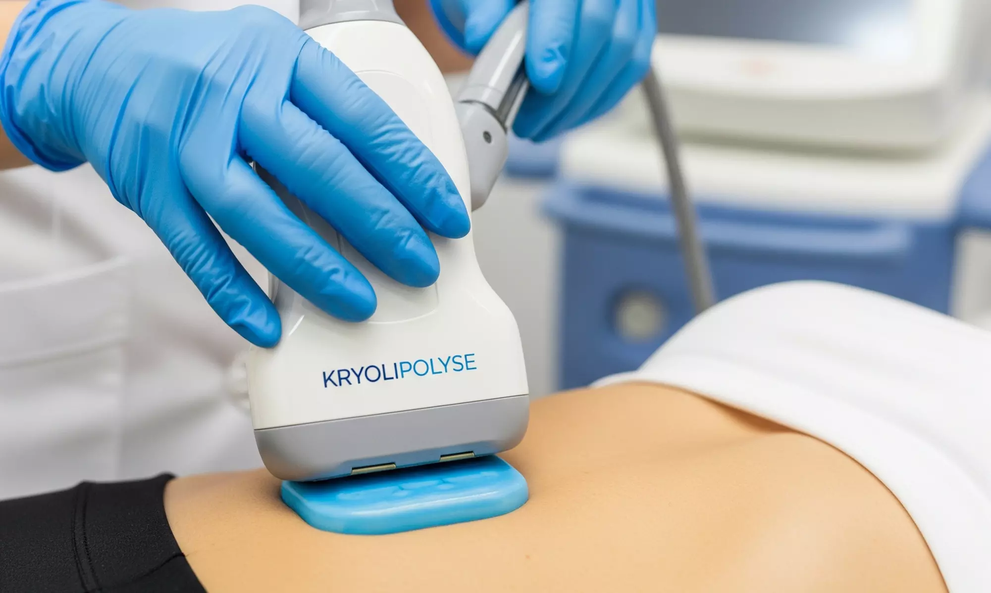 1-3 Behandlungen: 45 Min. Kryolipolyse-Behandlung an Zone mit Beratung