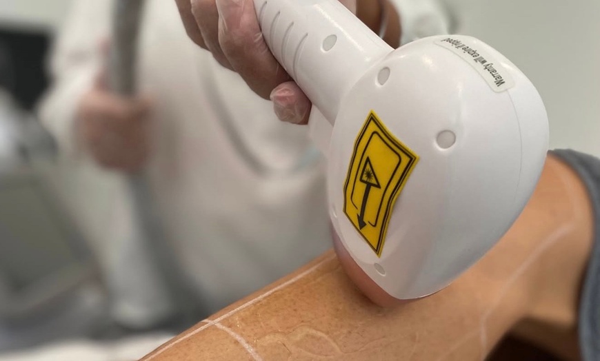 Image 1: Ice Laser Hair Removal for Small to Large Body Areas