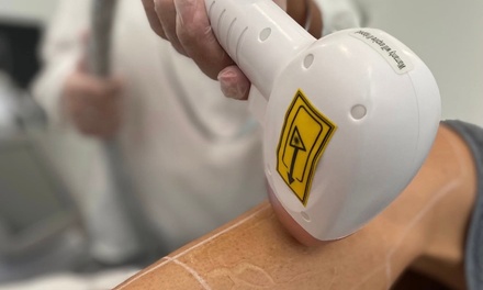 Small Area: Six Sessions of Advanced Diode Ice Laser Hair Removal - Herou Aesthetics Lab