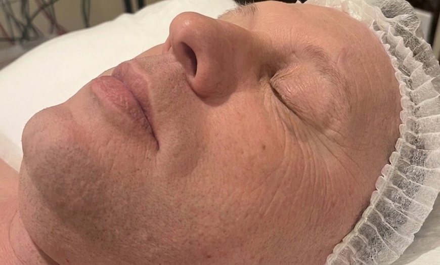 Image 3: Anti-Aging Facial with Light Therapy or Hydro Mask