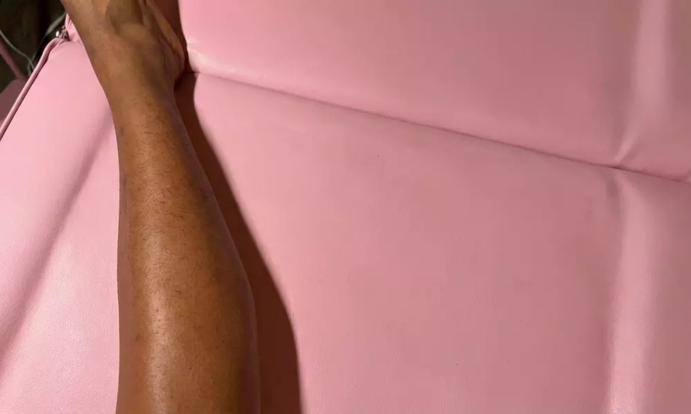 Get Silky Smooth Skin with One, Three, or Five Bikini Waxing Packages