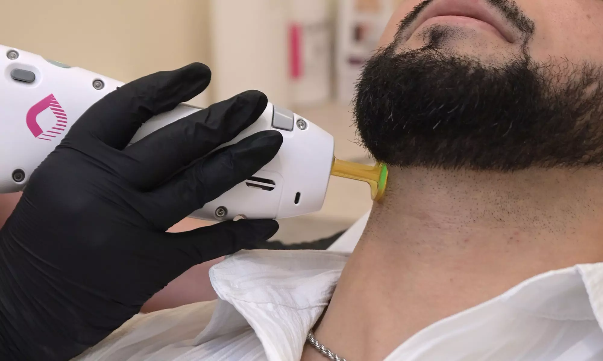 Revitalize Your Skin with Laser Hair Removal Sessions at Proesēns MedSpa - Choose Your Package (Up To 92% Off) - Second Medium