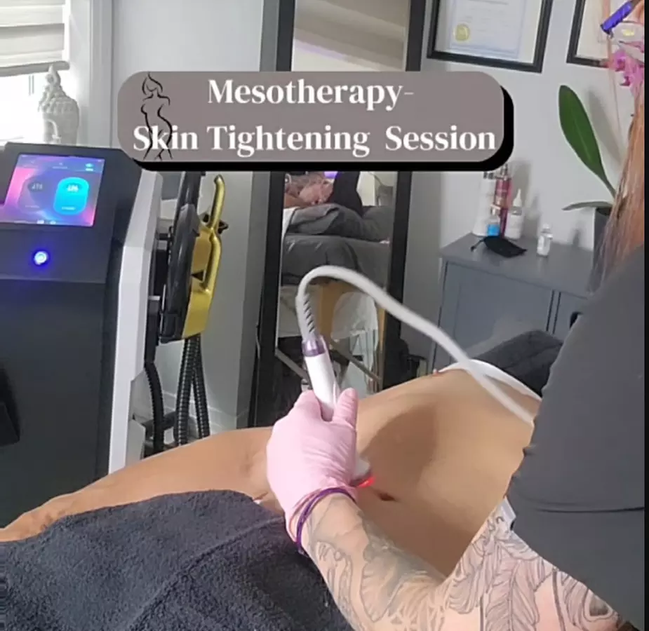 1, 2, or 3 Mini Mommy Make Over with Vacuum Therapy and More