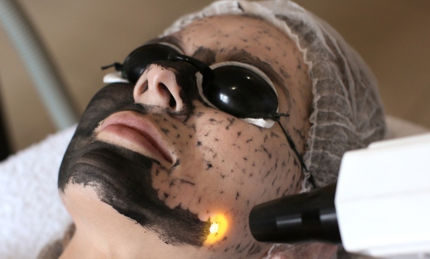 Image 1: Glow w/ choice of 30-Min LED, Hydro Facial or Hollywood Carbon Laser