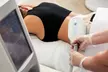Sculpt Your Shape with Cryolipolysis Treatment on 1 or 2 Areas at Glow Sculpt Studio (Up to 52% Off) - Second Medium