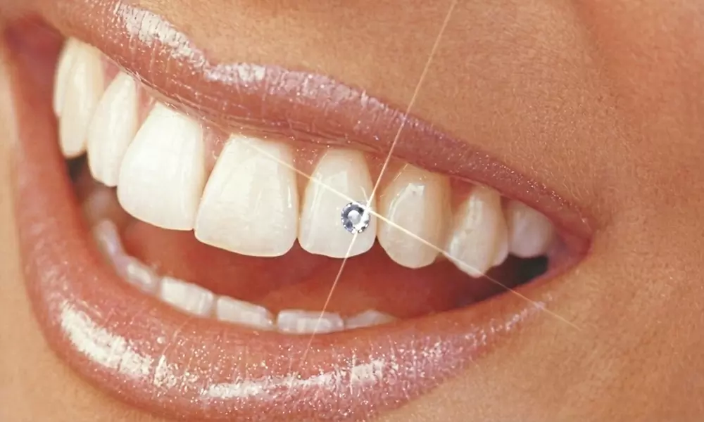 Dazzle Your Smile: 1, 2/ 4 Round, 1 Heart or 1 Butterfly Set Tooth Gem