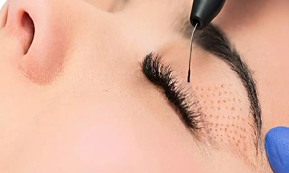 1 o 2 sesiones de plasma pen en zona a elegir para 1 persona