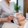 Image 1: Experience Skin Rejuvenation with Micro-Needling Treatments