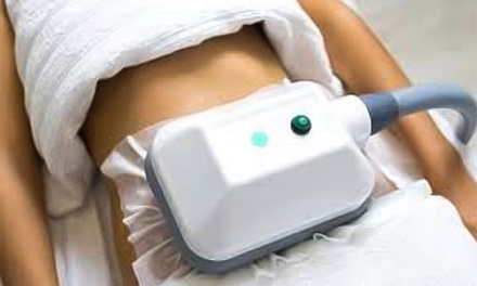 1 séance de cryolipolyse sur 1 zone au choix