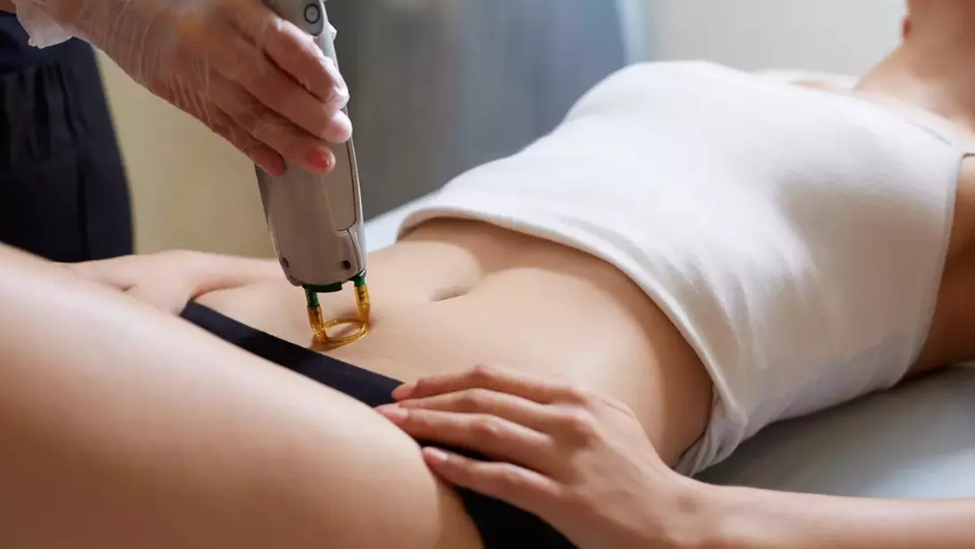 Six Laser Hair Removal Sessions on Small, Medium, or Large Areas