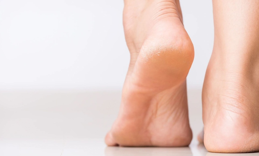 Image 3: General Foot Care w/ Trimming & Filing Or Foot Soak, Foot Bath & More