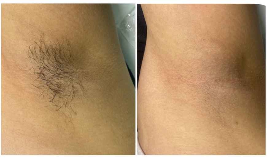 Image 3: Smooth Skin: Full Brazilian, Full Leg, Face, Arm, Brow or Underarm Wax