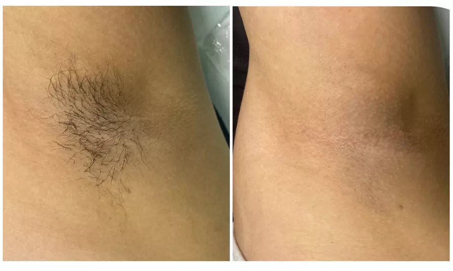 Smooth Skin: Full Brazilian, Full Leg, Face, Arm, Brow, or Underarm Wax at Jb empire esthetics (Up to 30% Off) - Second Medium
