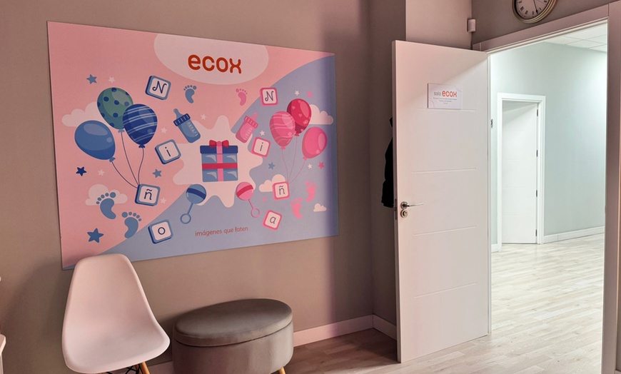 Image 3: ¡Conoce a tu bebé! Ecografía emocional 5D o 8K con vídeo y canastilla