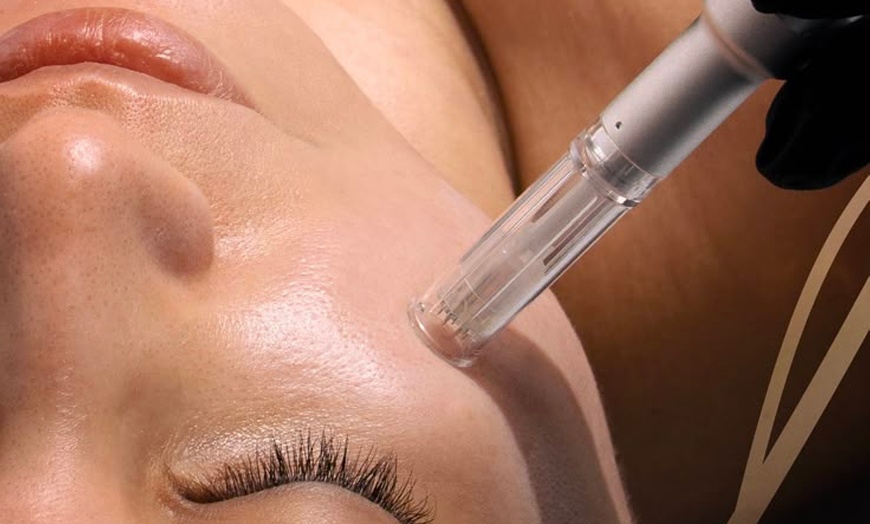 Image 1: Up to 60% Off on Micro-Needling at IV Vital Health