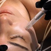 Image 1: Up to 60% Off on Micro-Needling at IV Vital Health