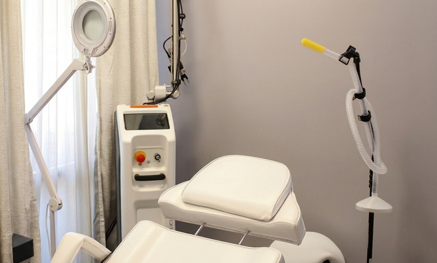 Image 5: 6 Splendor X Laser Hair Reduction Sessions for All Skin Types