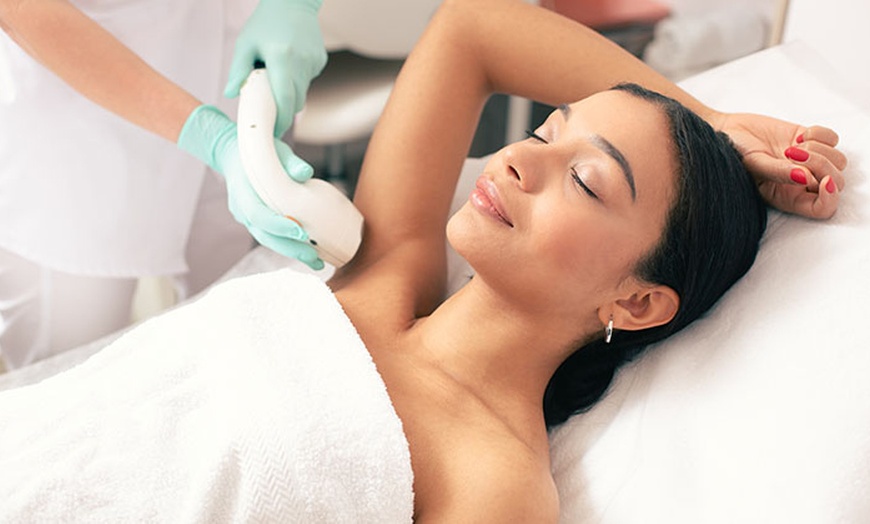 Image 2: Medical-Grade Laser Hair Removal for Smooth and Lasting Results
