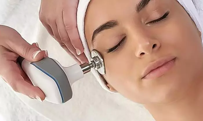 1 o 2 sesiones de radiofrecuencia facial Indiba para 1 persona