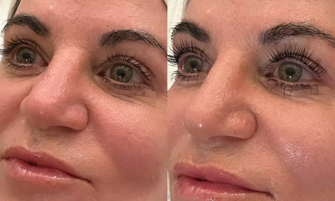 Get One Eyelash Lift & Tint Treatment with Optinal Brow Lamination