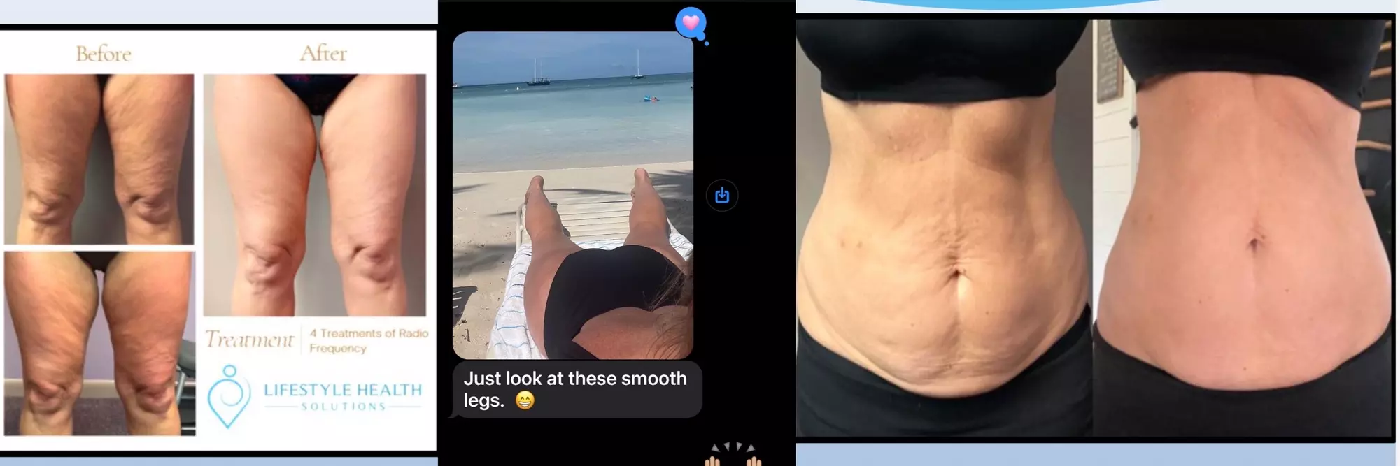 30-Minute T-Shape 2'' Massage w/ Optional Styku 3D Body Scan for 1 at Lifestyle Health Solutions (Up to 64% Off)