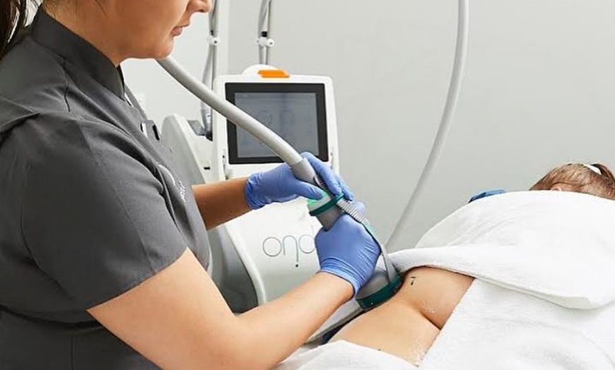 Image 5: Keep It Clear: Up to Three Skin Tag Removal Sessions